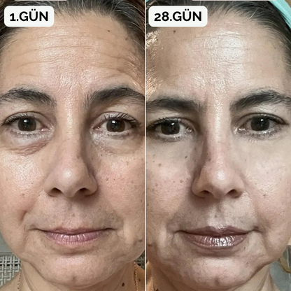 RevitalEyes® Göz Altı Onarıcı Gözlük