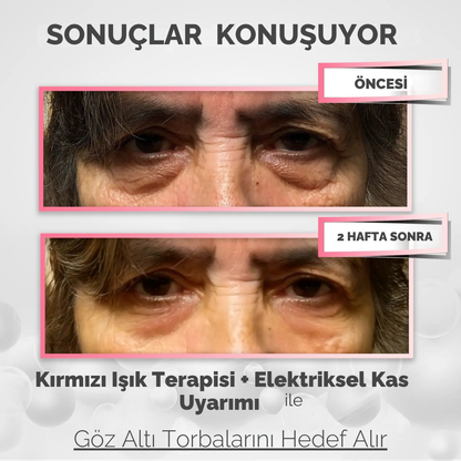 RevitalEyes® Göz Altı Onarıcı Gözlük